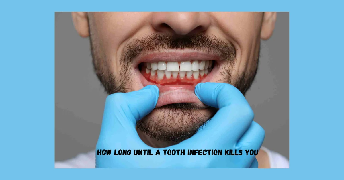 How Long Until a Tooth Infection Kills You: Understanding the Stages and Risks