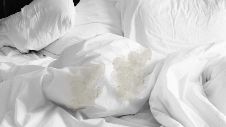 How to Prevent and Treat Bedwetting in Adults